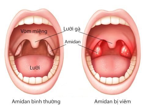 amidan là gì