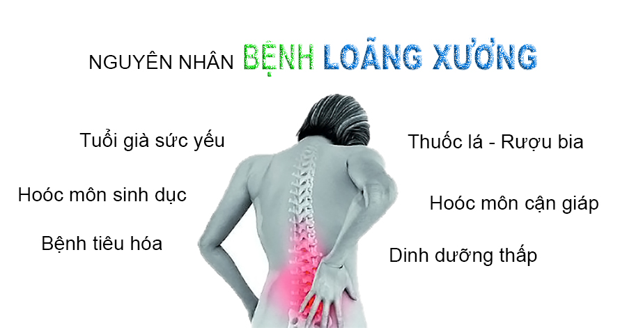 Bệnh loãng xương gây ra những hậu quả gì